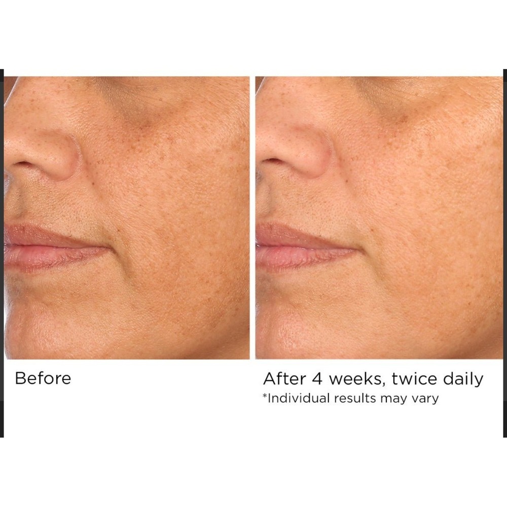 NassifMD Hydro Screen Serum 2 Bottles Hyaluronic Retinol Anti Aging - Picture 5 of 5